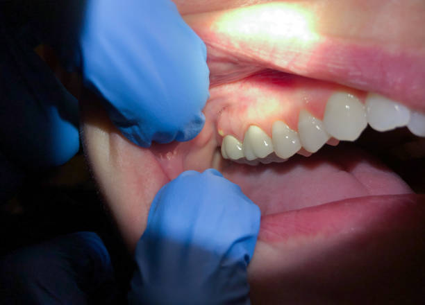 Best Emergency Treatment for Toothache in Gurdon, AR