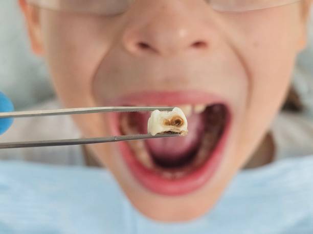 Best Pediatric Emergency Dentist in Gurdon, AR